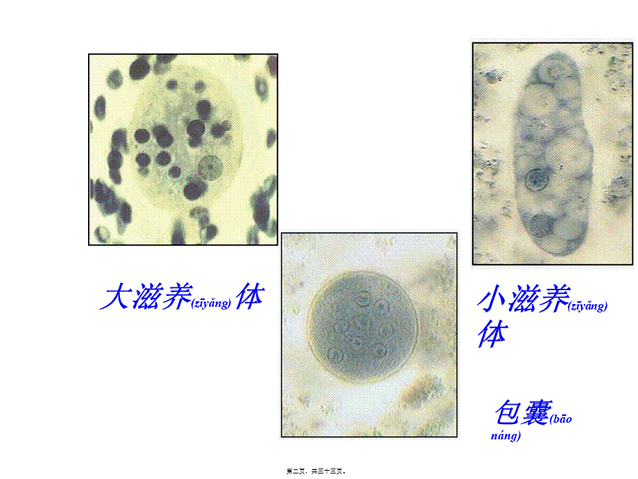 2022年医学专题—抗阿米巴虫驱肠虫药(1).ppt_第2页