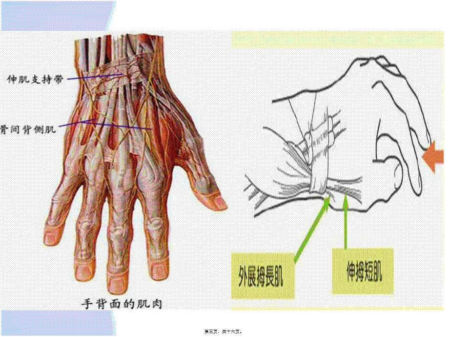 2022年医学专题—挠骨茎突狭窄性腱鞘炎(1).ppt_第3页