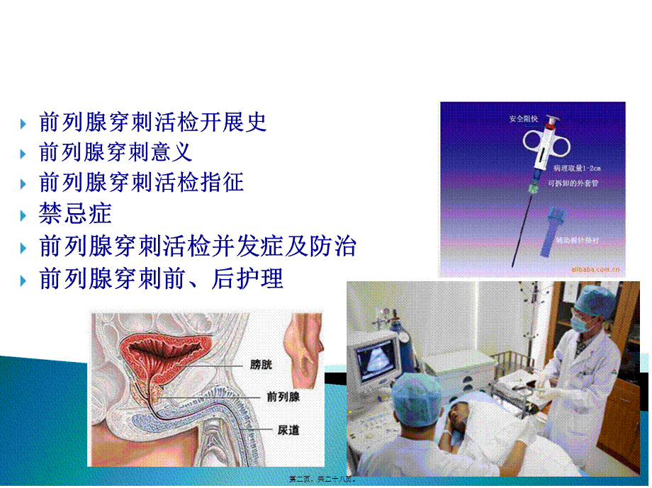 前列腺穿刺活检.pptx_第2页