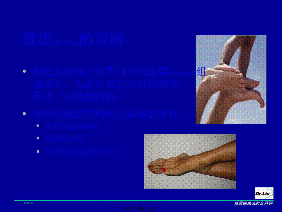 2022年医学专题—糖尿病足的防治.ppt_第2页