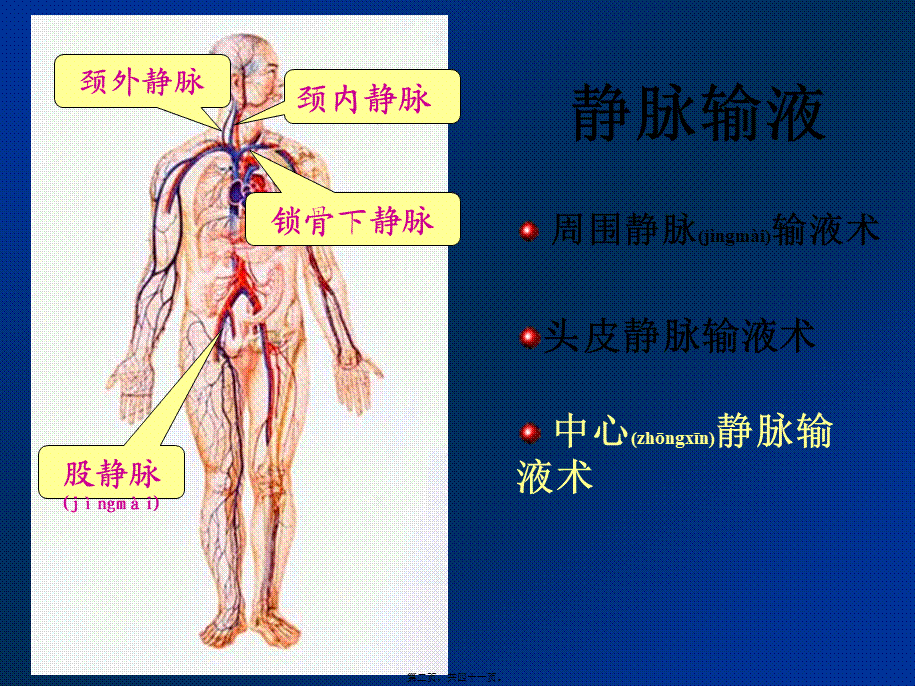 2022年医学专题—深静脉输液讲义..ppt_第2页