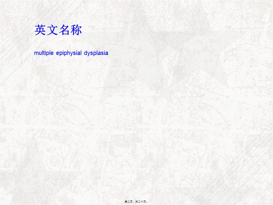 2022年医学专题—多发性骨骺发育不良概述.ppt_第2页