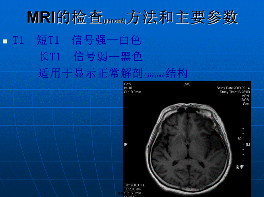 2022年医学专题—脑部磁共振呈像.ppt_第3页