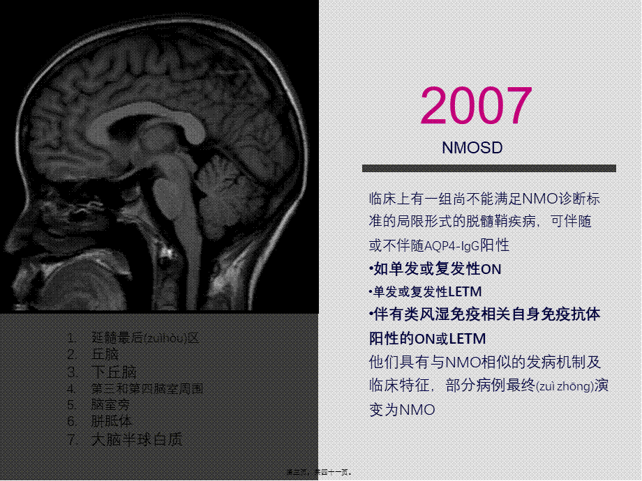 2022年医学专题—中国NMOSD诊治指南2015(1).ppt_第3页