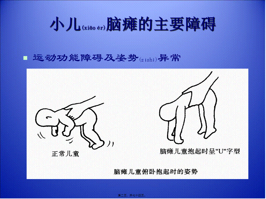 2022年医学专题—小儿脑瘫康复.ppt_第2页