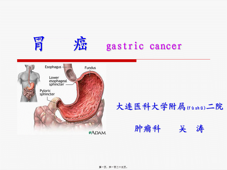 2022年医学专题—胃癌20091114.ppt_第1页