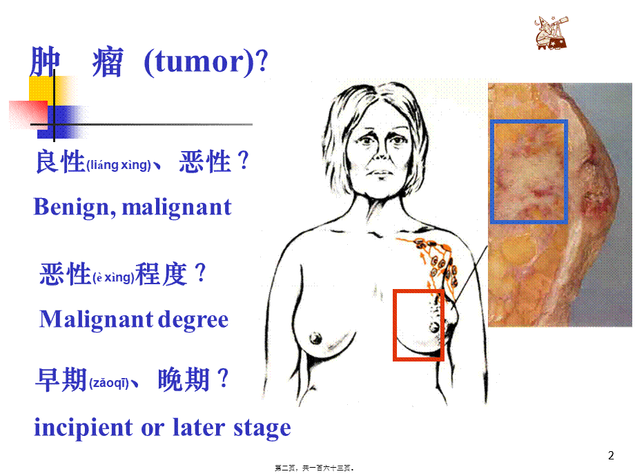 2022年医学专题—肿----瘤3-1(1).ppt_第2页