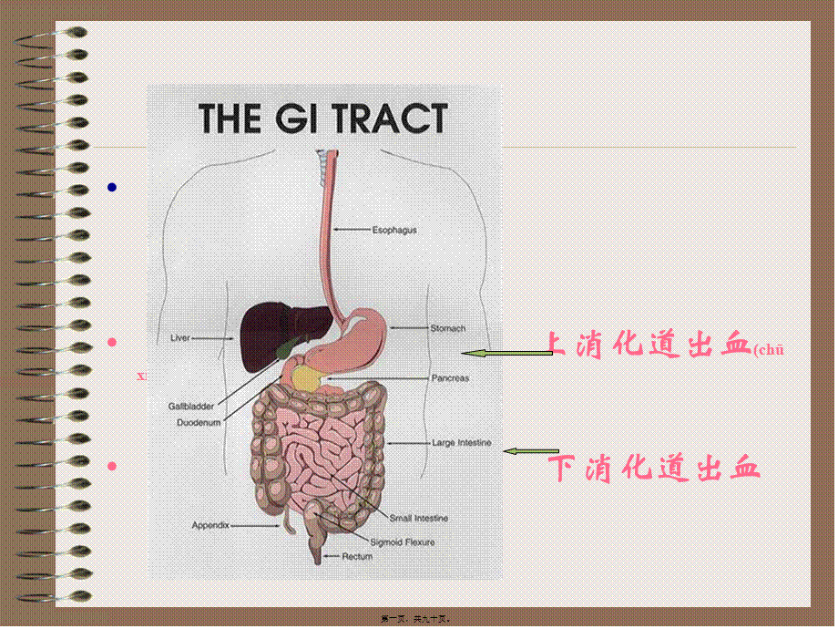 2022年医学专题—上消道大量出血-精选文档.ppt_第1页