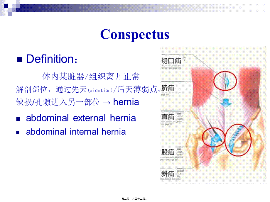 2022年医学专题—腹外疝(上网版).ppt_第2页