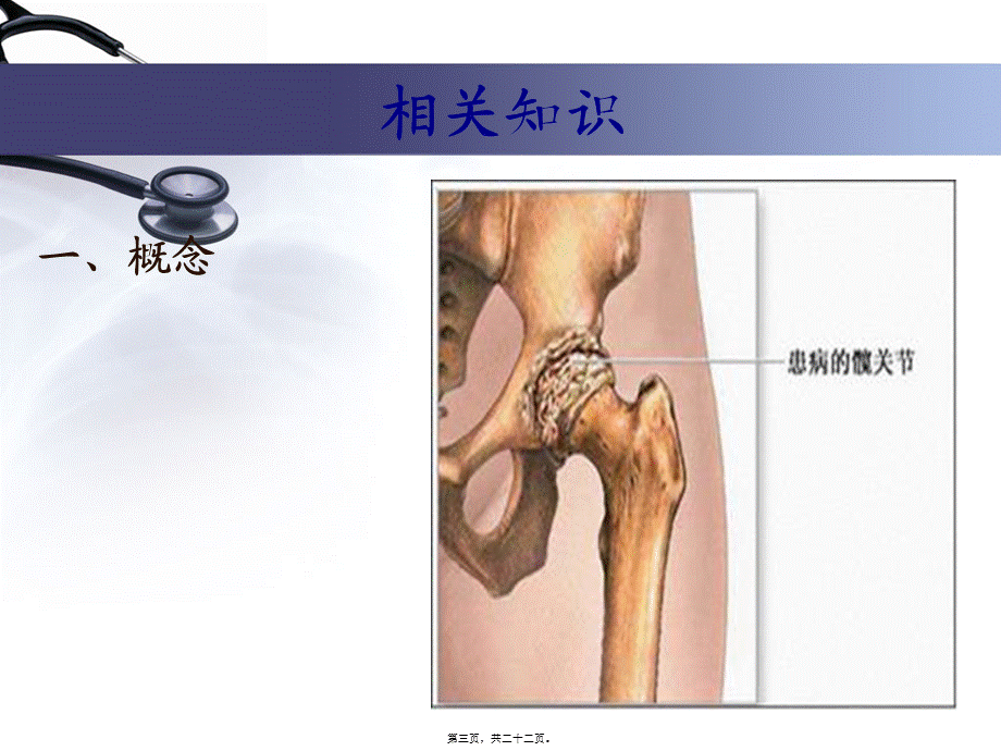 人工全髋关节置换术.pptx_第3页