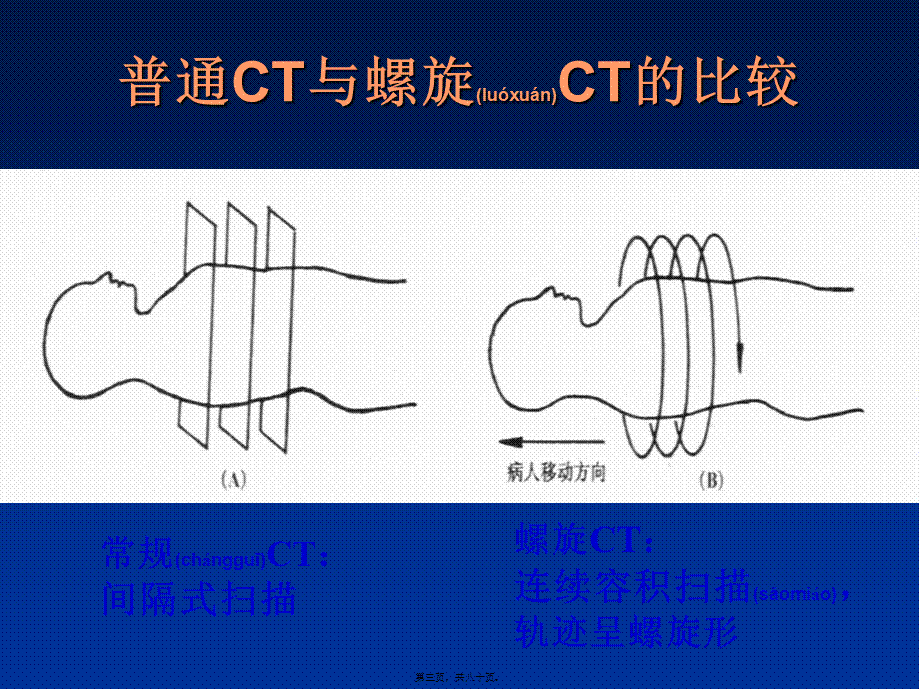 2022年医学专题—田氏西门子16排螺旋CT后处理技术的骨科应用(1).ppt_第3页