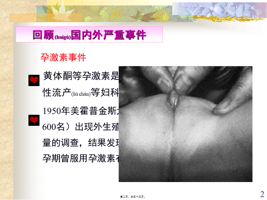 2022年医学专题—秋-妊娠期合理用药.ppt_第2页