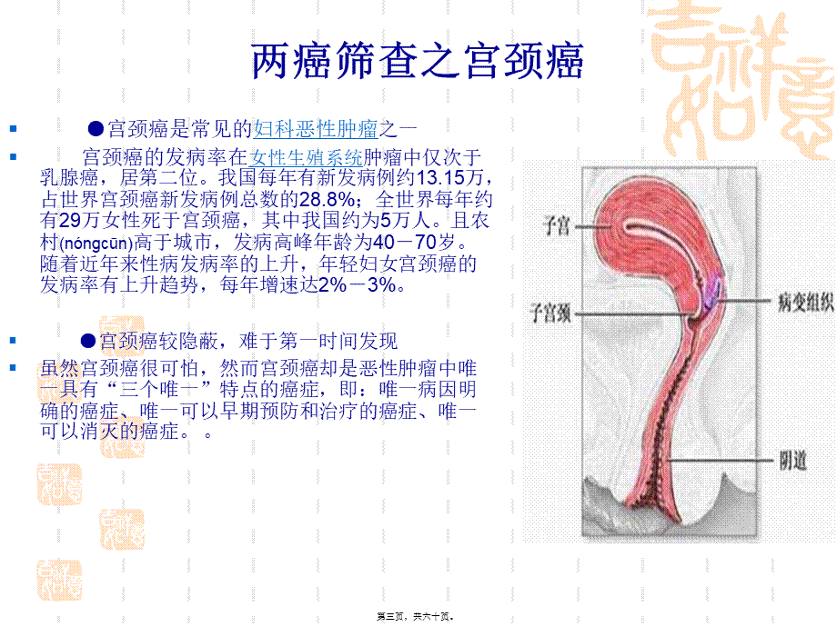 2022年医学专题—关注女性健康-开展两癌筛查.ppt_第3页