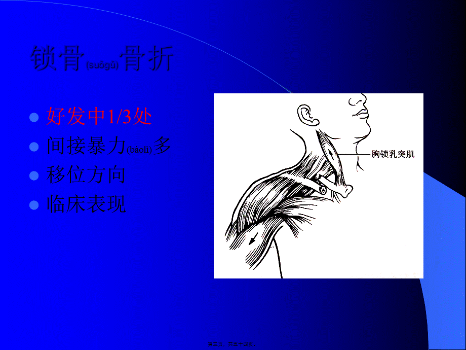 2022年医学专题—上肢下肢骨折.ppt_第3页