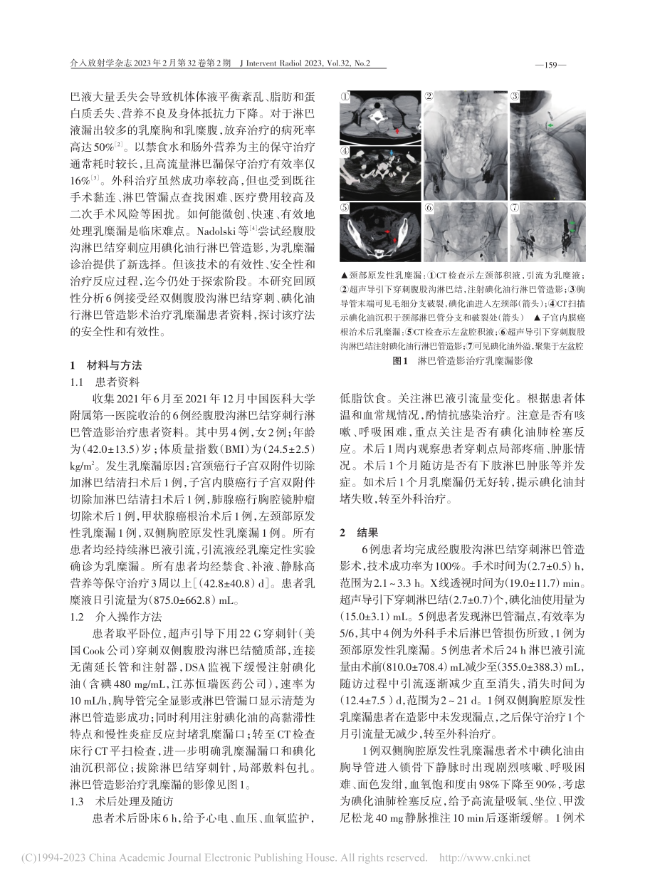 经腹股沟淋巴结穿刺淋巴管造影诊断和治疗乳糜漏6例_白旭.pdf_第2页