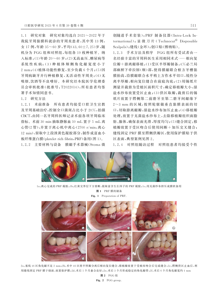 角化龈增量对维护牙周炎患者种植体稳定性的临床研究_陆杰.pdf_第2页