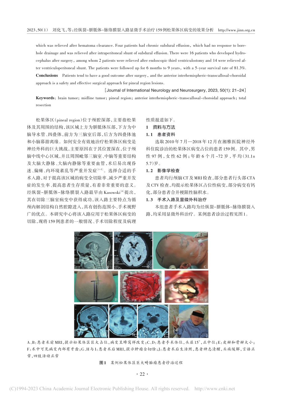 经纵裂-胼胝体-脉络膜裂入...9例松果体区病变的效果分析_刘化飞.pdf_第2页