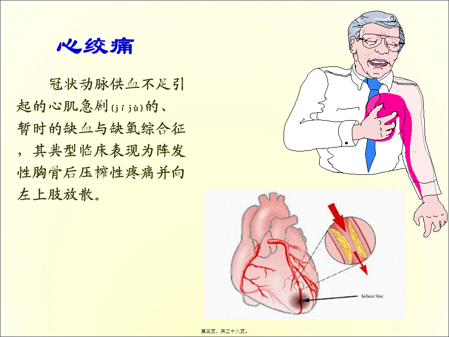 2022年医学专题—第二十四章抗心绞痛药.ppt_第3页