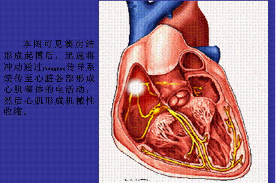 2022年医学专题—爱爱医资源-心电图绝好.ppt.ppt_第3页