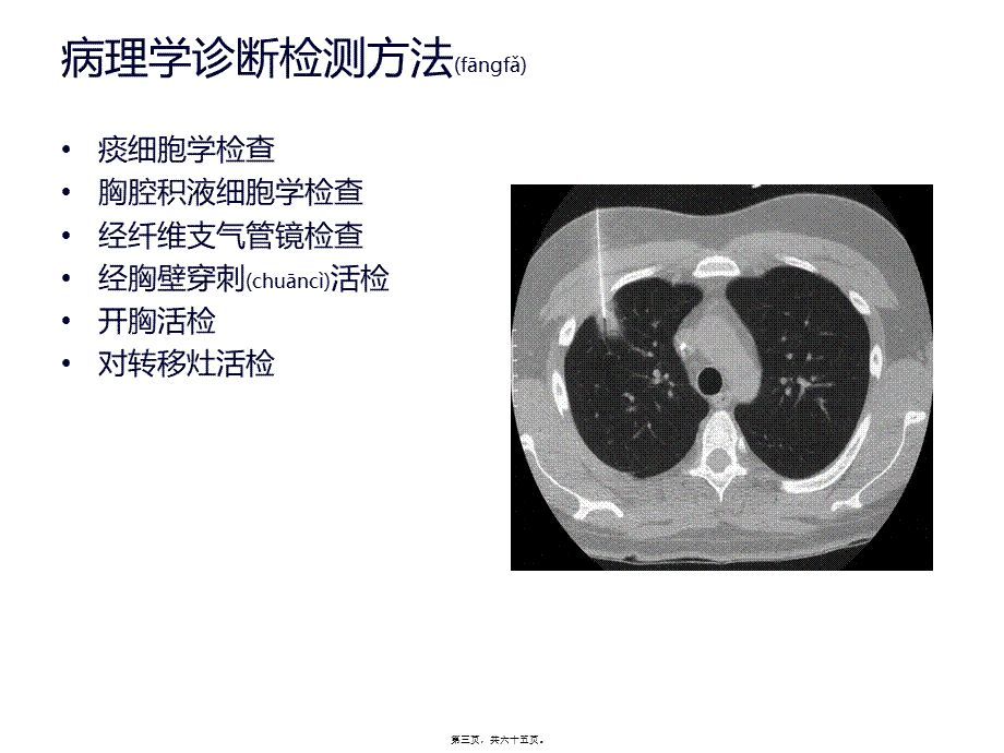 2022年医学专题—肺癌患者围术期处理新进展.ppt_第3页