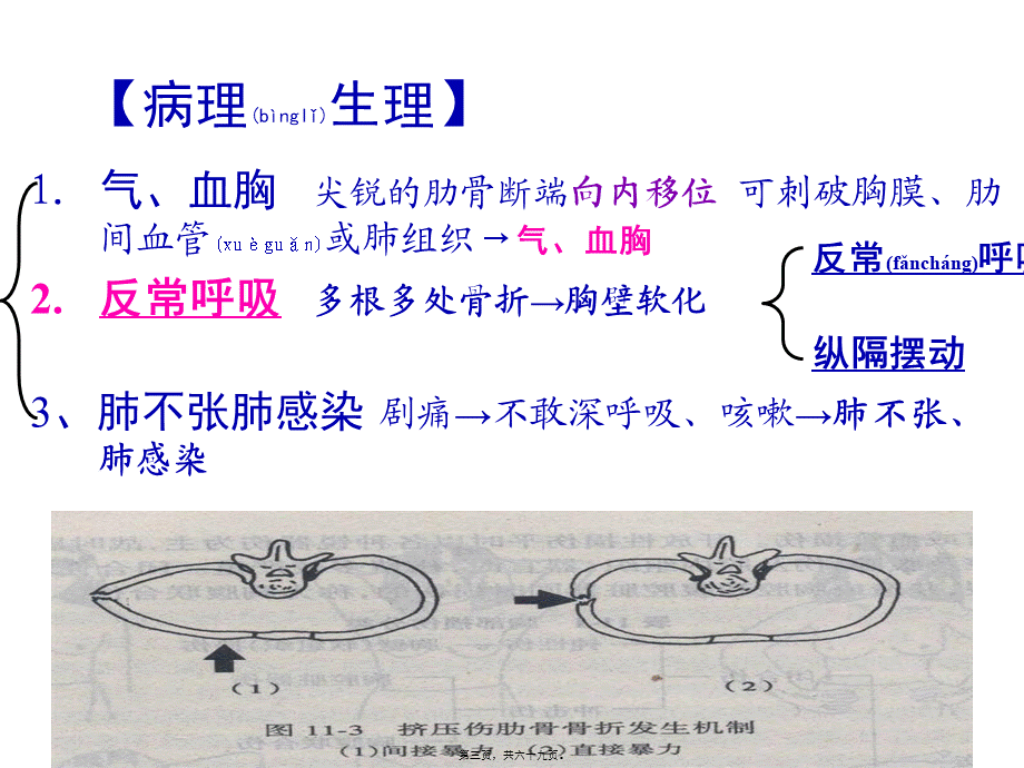 2022年医学专题—胸、腹部损伤.ppt_第3页