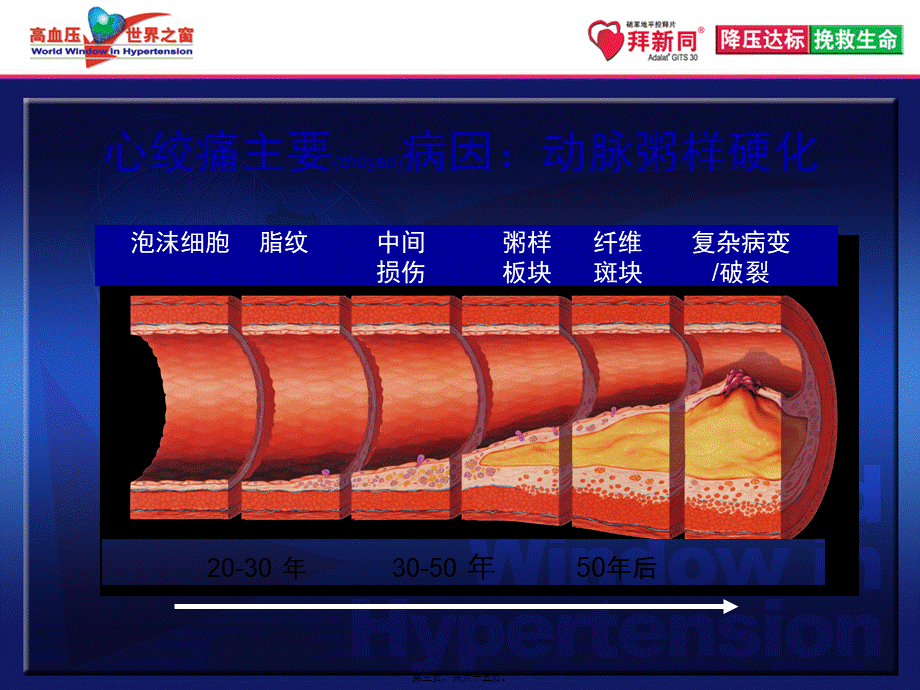 2022年医学专题—中国稳定性心绞痛指南带来的启示+解说词-final.ppt_第3页