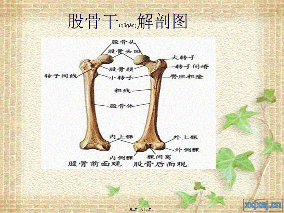 2022年医学专题—股骨干骨折(2012.10)...ppt_第2页