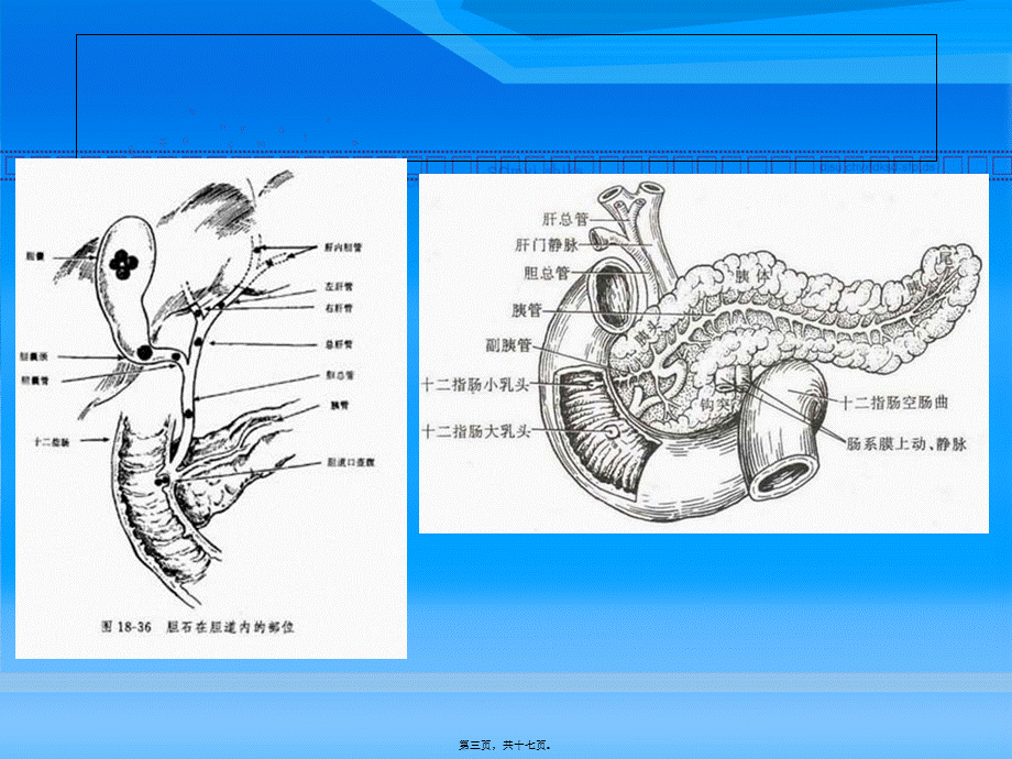 2022年医学专题—壶腹部占位检查方法.ppt_第3页