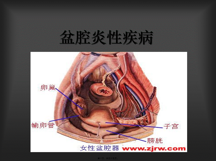 2022年医学专题—盆腔炎-20150401.ppt_第1页