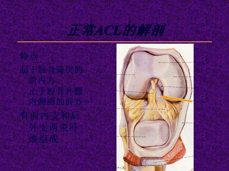 关节镜下膝前交叉韧带损伤的诊治.pptx_第3页