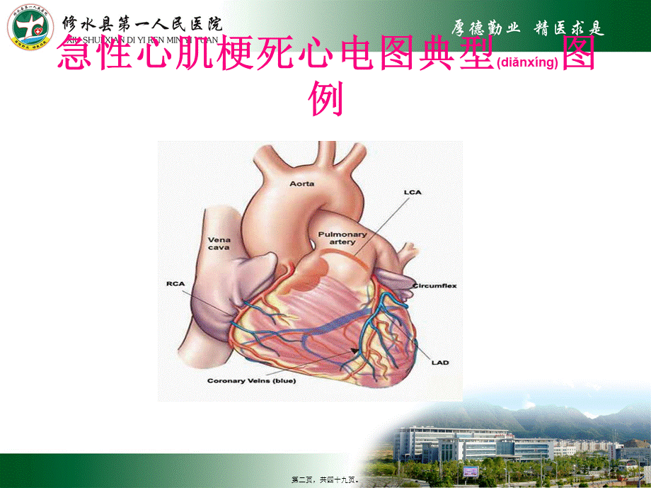 2022年医学专题—急性心肌梗死及常见心电图识别.pptx_第2页