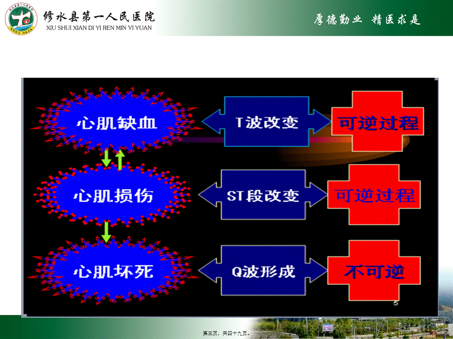 2022年医学专题—急性心肌梗死及常见心电图识别.pptx_第3页