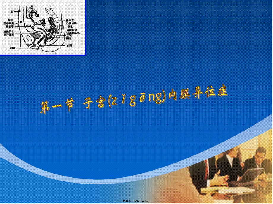 2022年医学专题—子宫内膜异位症和子宫腺肌病.ppt_第3页