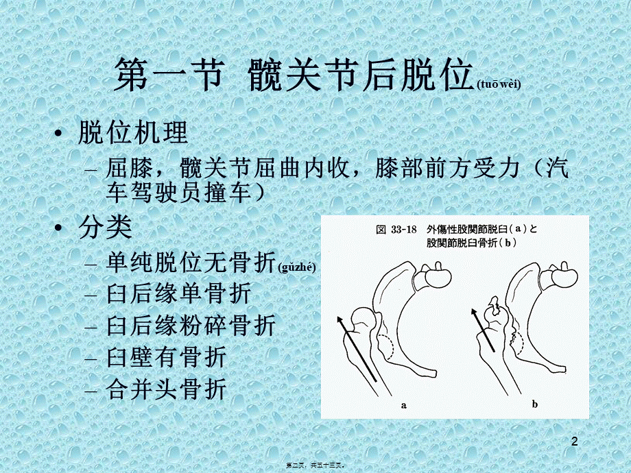 2022年医学专题—下肢骨、关节损伤.ppt_第2页