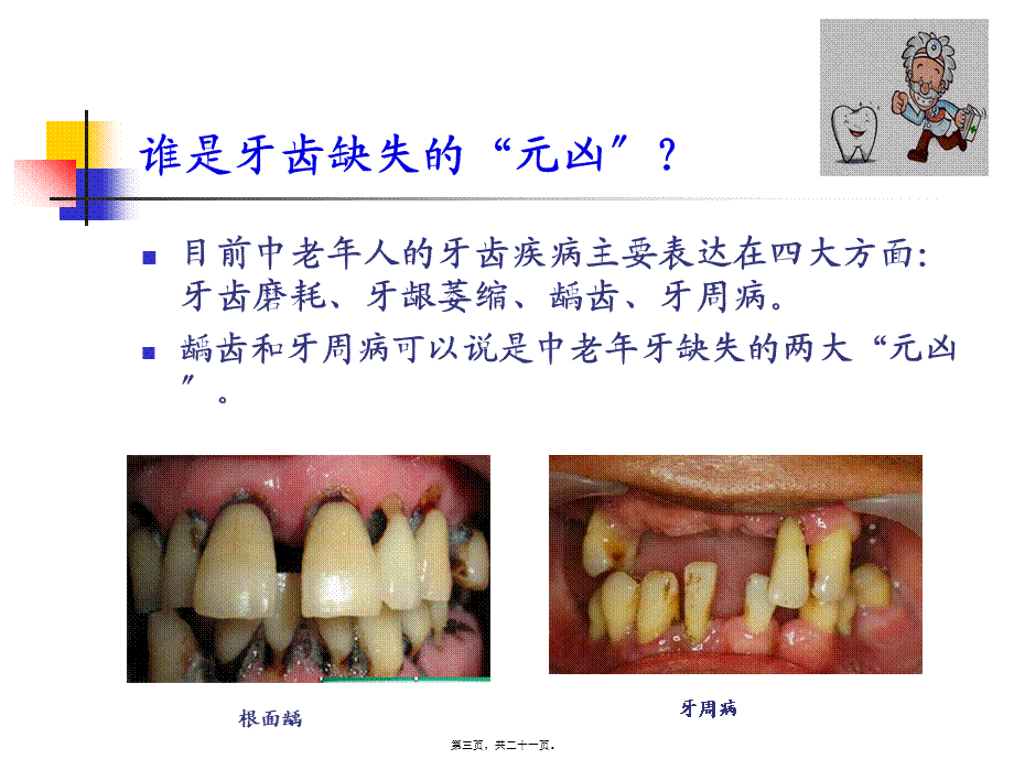 口腔科——中老年科普知识讲座.pptx_第3页