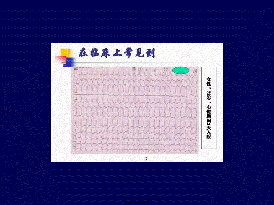 2022年医学专题—快速性心律失常急诊处理策略.ppt_第2页