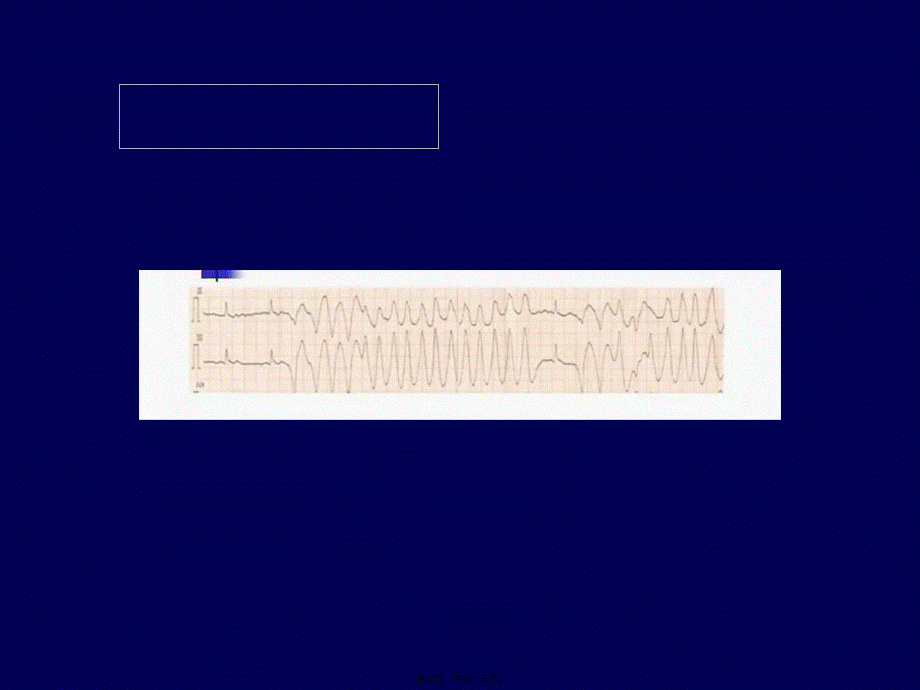 2022年医学专题—快速性心律失常急诊处理策略.ppt_第3页