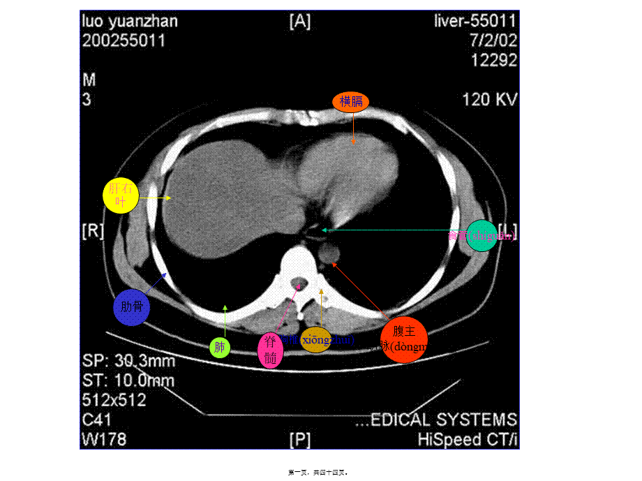 2022年医学专题—腹部CT读片.ppt_第1页