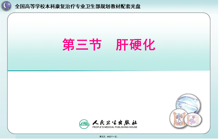 2022年医学专题—第三节-肝硬化讲述.ppt_第3页