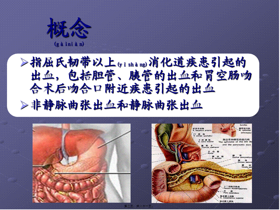 2022年医学专题—上消化道出血的诊治基础和进展.ppt_第2页