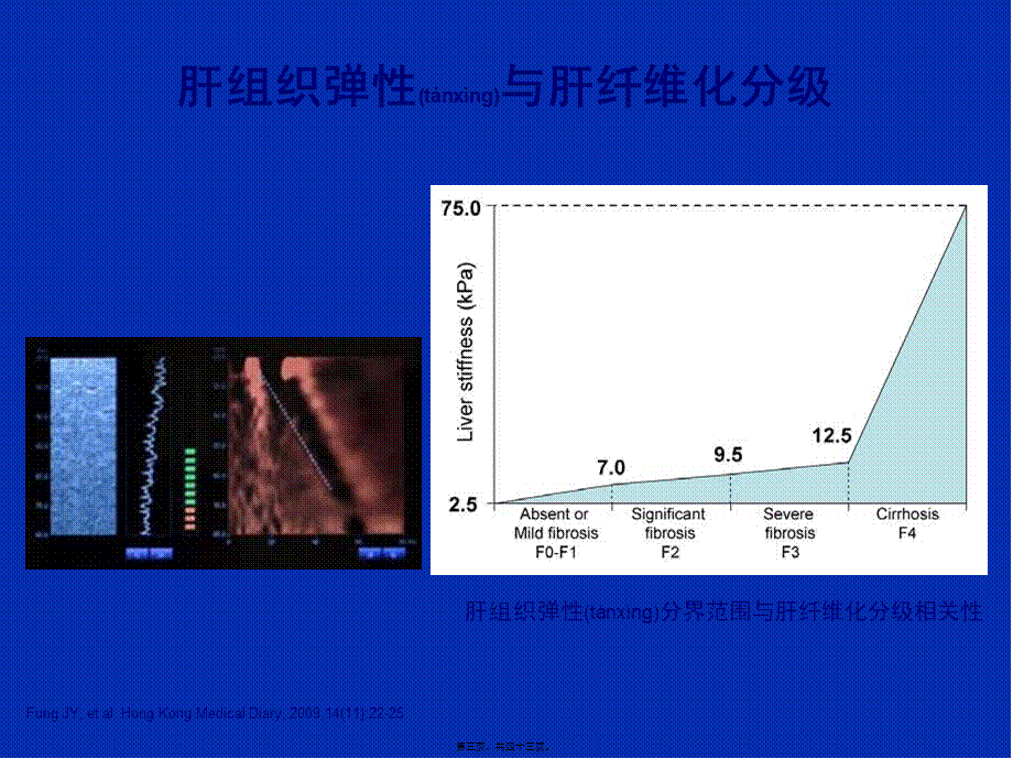 2022年医学专题—乙肝肝硬化并发症的处理.ppt_第3页