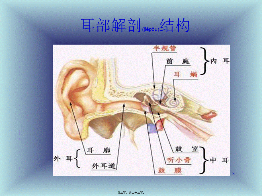 2022年医学专题—胆脂瘤型中耳炎.ppt_第3页