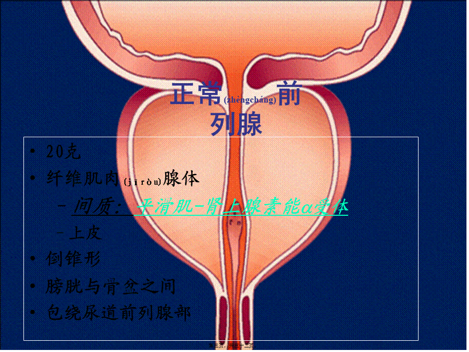 2022年医学专题—泌尿系统梗阻PPT.ppt_第3页