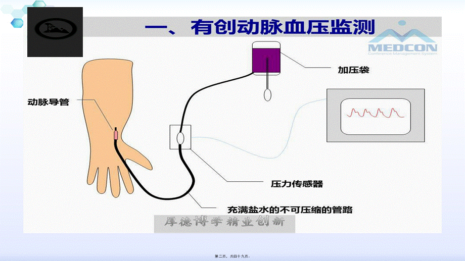 2022年医学专题—有创血流动力学监测.ppt.pptx_第2页