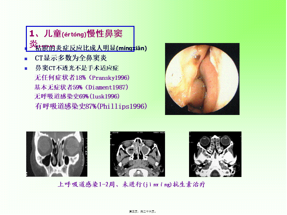 2022年医学专题—儿童鼻窦炎ppt.ppt_第3页