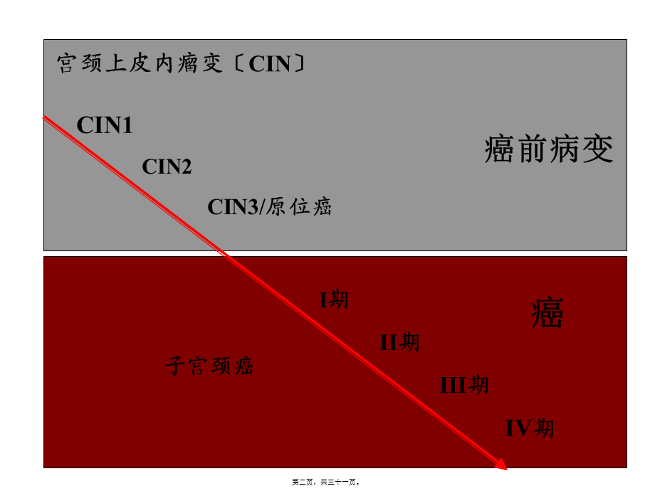 宫颈癌前病变的处理.pptx_第2页