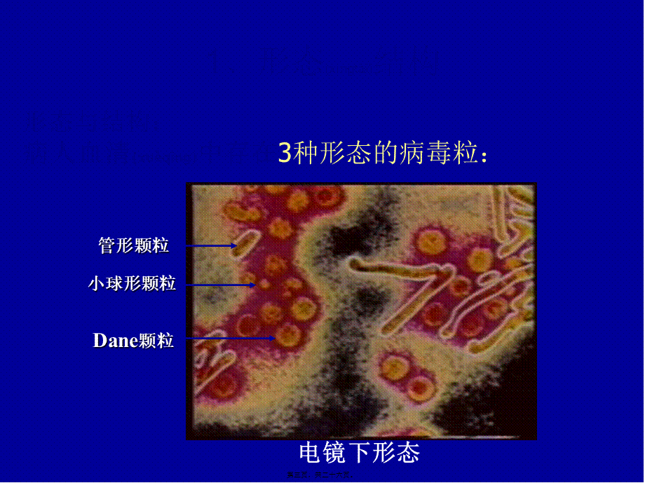 2022年医学专题—HBV-X-蛋白与原发性肝癌.ppt_第3页