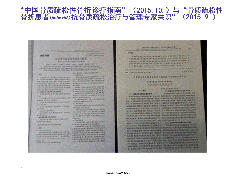 2022年医学专题—《中国骨质疏松性骨折诊疗指南》解读.ppt_第3页