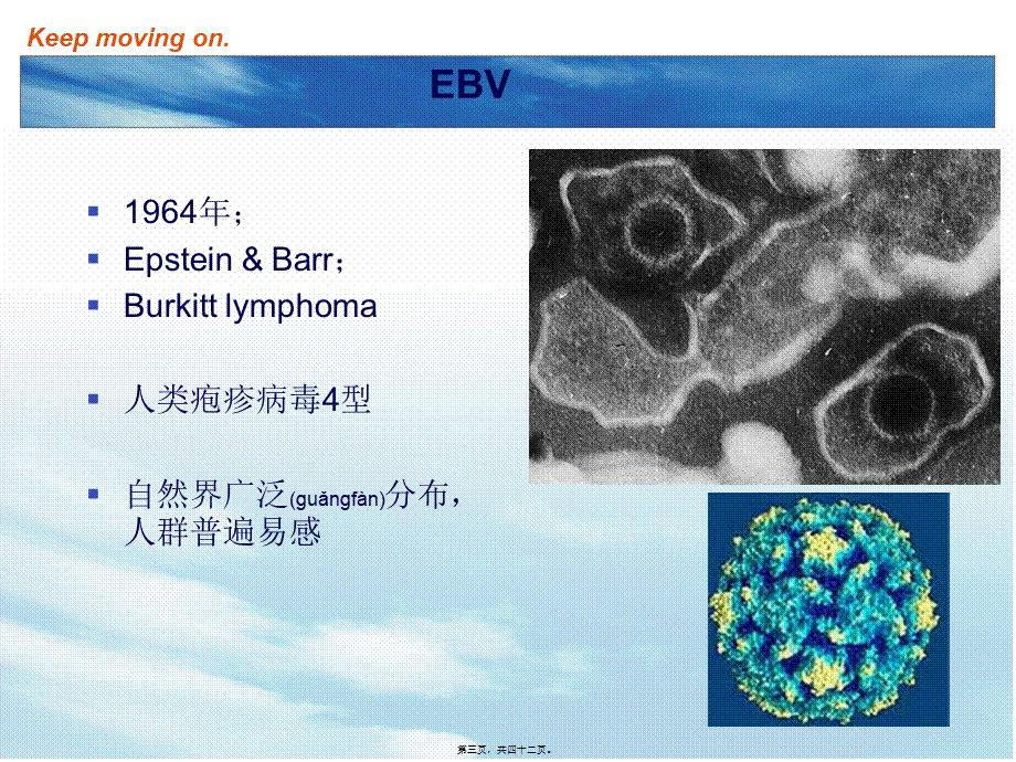 2022年医学专题—EBV及传染性单核细胞增多症.ppt_第3页