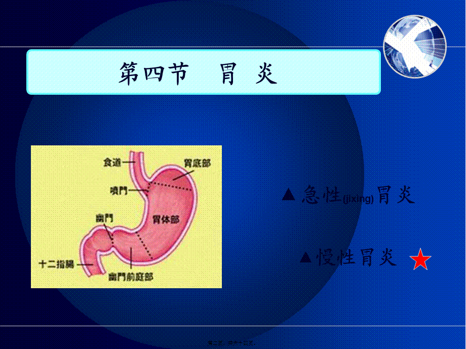 2022年医学专题—第四节---胃-炎(本科).ppt_第2页